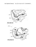 NASAL CANNULA ASSEMBLIES AND RELATED PARTS diagram and image