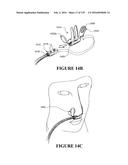 NASAL CANNULA ASSEMBLIES AND RELATED PARTS diagram and image