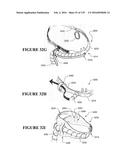 NASAL CANNULA ASSEMBLIES AND RELATED PARTS diagram and image