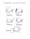 NASAL CANNULA ASSEMBLIES AND RELATED PARTS diagram and image