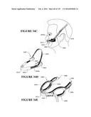 NASAL CANNULA ASSEMBLIES AND RELATED PARTS diagram and image