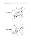 NASAL CANNULA ASSEMBLIES AND RELATED PARTS diagram and image