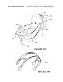 NASAL CANNULA ASSEMBLIES AND RELATED PARTS diagram and image