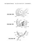 NASAL CANNULA ASSEMBLIES AND RELATED PARTS diagram and image