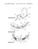 NASAL CANNULA ASSEMBLIES AND RELATED PARTS diagram and image