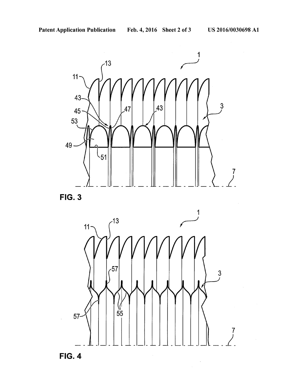 FLEXIBLE, EXTENSIBLE, COAXIAL TYPE TUBE SYSTEM - diagram, schematic, and image 03