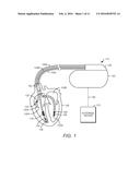 IMPLANTED LEAD ANALYSIS SYSTEM AND METHOD diagram and image