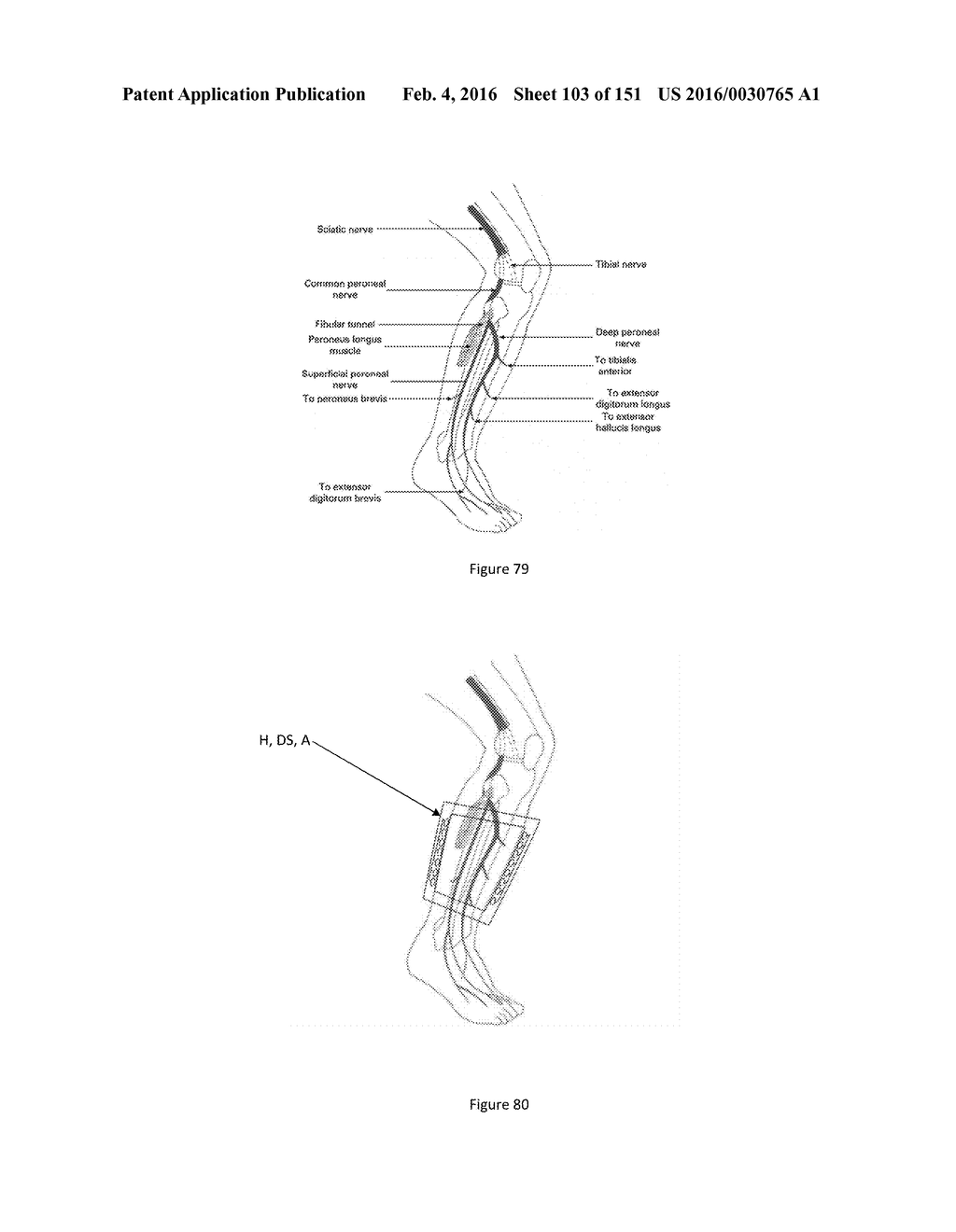 SYSTEM AND METHOD FOR OPTOGENETIC THERAPY - diagram, schematic, and image 104