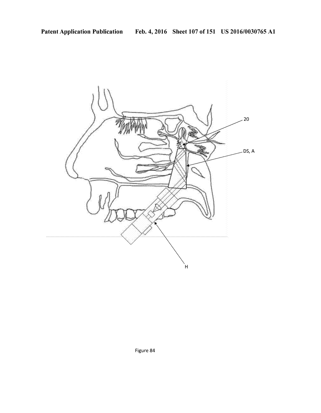 SYSTEM AND METHOD FOR OPTOGENETIC THERAPY - diagram, schematic, and image 108