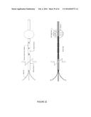 Ultrasound Therapy Catheter with Multi-Chambered Balloons for Transluminal     Longitudinal Positioning diagram and image