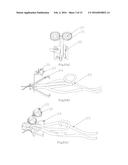 HETEROMORPHIC ATTACHMENT AND SYSTEM USED IN LASER GUNFIGHT GAME diagram and image