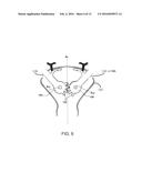 UNIVERSAL PAINT APPLICATOR AND PAINT CONTAINERS WITH HANDLES diagram and image