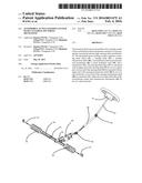 AUTOMOBILE ACTIVE STEERING SYSTEM WITH CYCLOIDAL-PIN WHEEL MECHANISM diagram and image