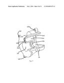 AUTOMOBILE ACTIVE STEERING SYSTEM WITH CYCLOIDAL-PIN WHEEL MECHANISM diagram and image