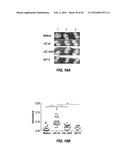 TREATMENT OF STAPHYLOCOCCAL DISORDERS diagram and image