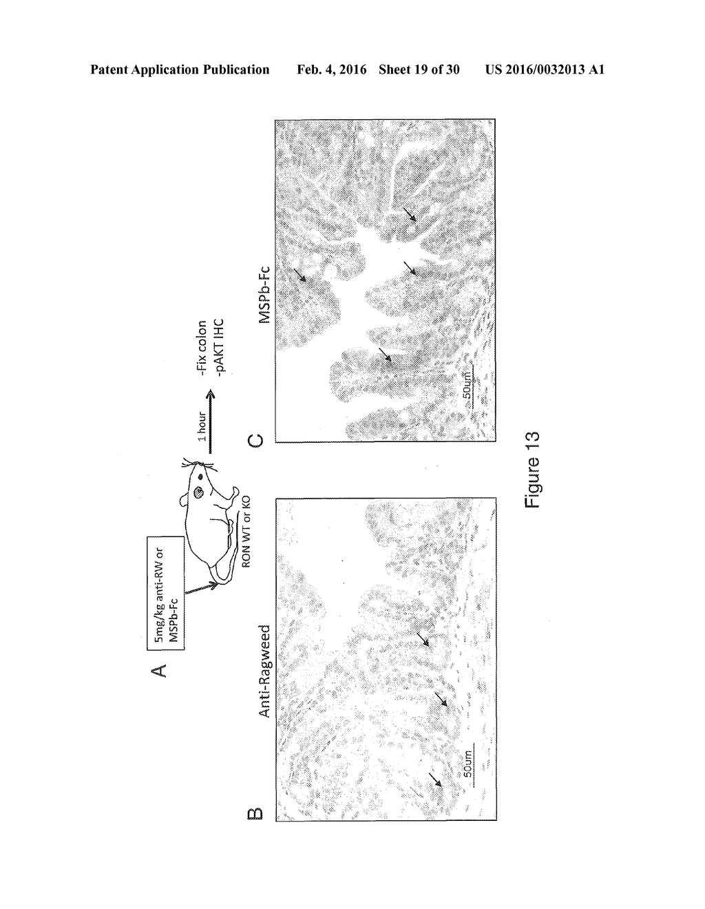 RON COMPOSITIONS AND METHODS OF USE THEREOF - diagram, schematic, and image 20