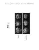 CONTROLLING FUNGAL PATHOGENS BY DISABLING THEIR SMALL RNA PATHWAYS USING     RNAi-BASED STRATEGY diagram and image