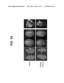 CONTROLLING FUNGAL PATHOGENS BY DISABLING THEIR SMALL RNA PATHWAYS USING     RNAi-BASED STRATEGY diagram and image