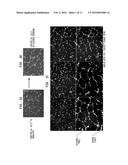 SERUM-BASED, DIAGNOSTIC, BIOLOGICAL ASSAY TO PREDICT PREGNANCY DISORDERS diagram and image