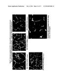 SERUM-BASED, DIAGNOSTIC, BIOLOGICAL ASSAY TO PREDICT PREGNANCY DISORDERS diagram and image