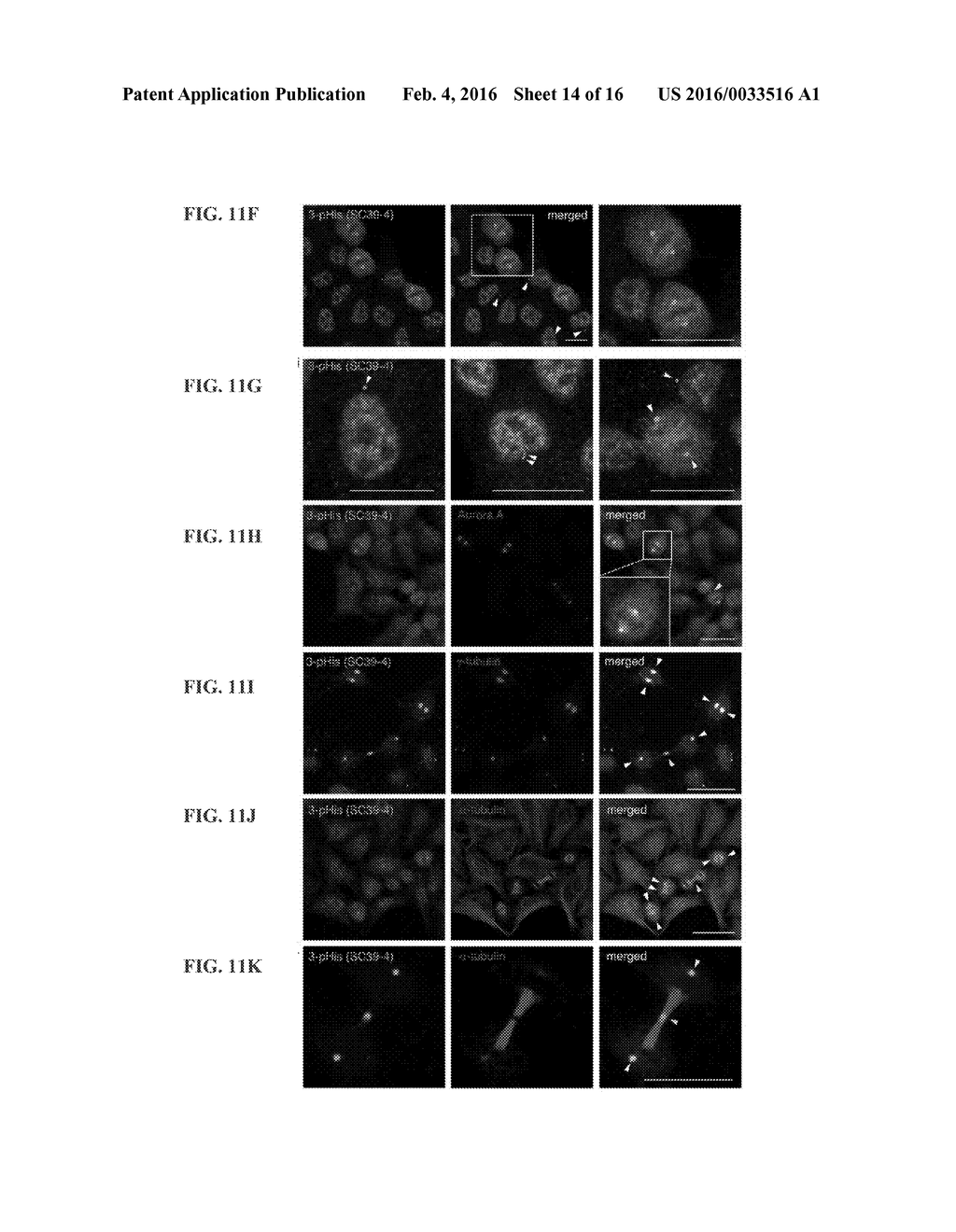 USE OF POLYCLONAL AND MONOCLONAL ANTIBODIES SPECIFIC FOR     3-PHOSPHOHISTIDINE - diagram, schematic, and image 15