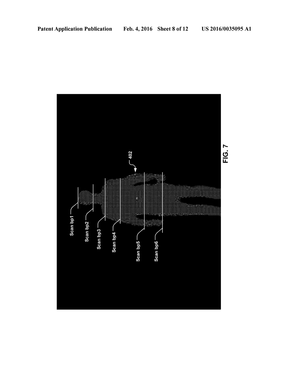 Systems And Methods For Detecting A Tilt Angle From A Depth Image - diagram, schematic, and image 09