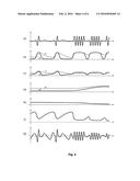 IMPROVED DYNAMIC COMPRESSOR WITH  RELEASE  FEATURE diagram and image