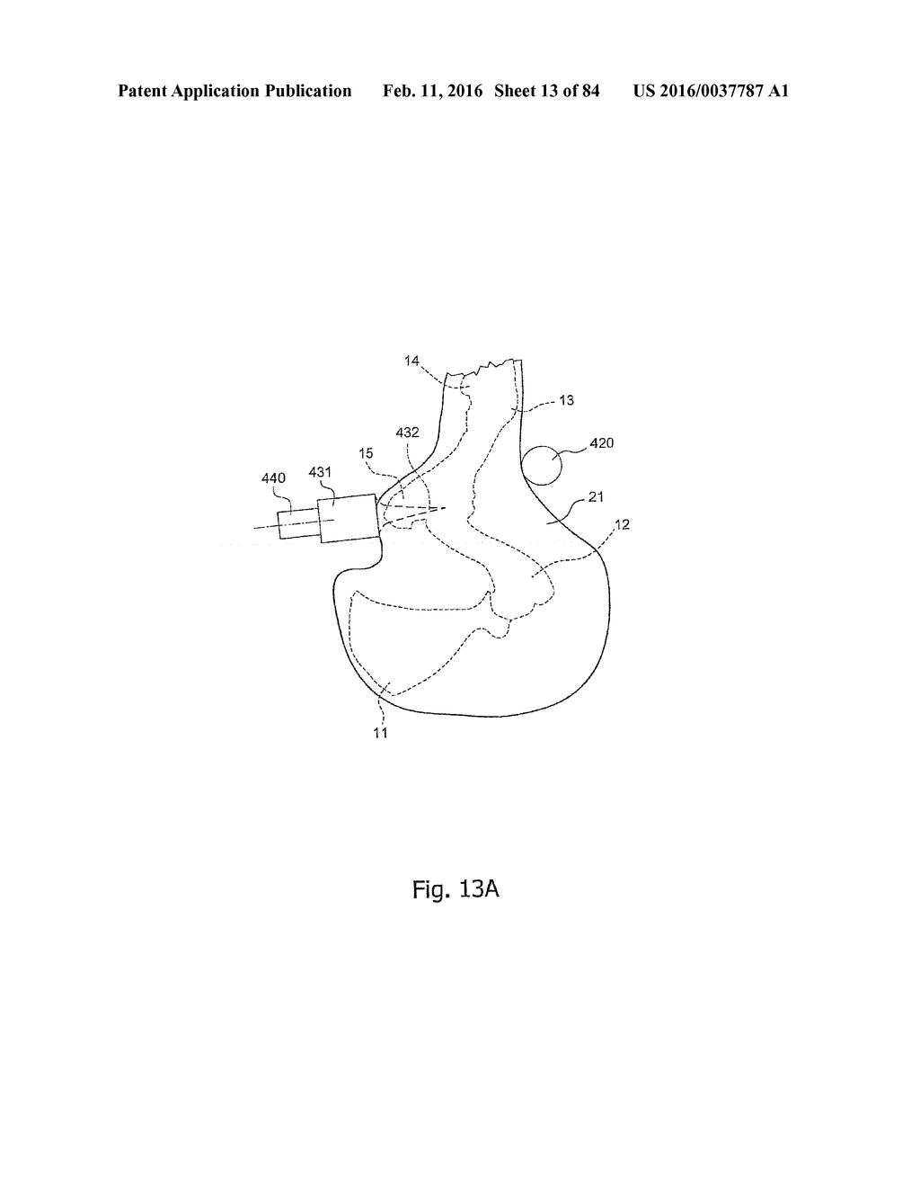 SYSTEM AND METHOD FOR PROCESSING SLAUGHTERED ANIMALS AND/OR PARTS THEREOF - diagram, schematic, and image 14