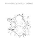 POST-SURGICAL GARMENT diagram and image