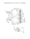 POST-SURGICAL GARMENT diagram and image