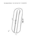 ATTACHMENT SYSTEM FOR AN ELECTRONIC DEVICE diagram and image