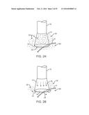 Tissue Visualization Device And Method Variations diagram and image