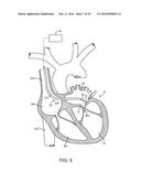 Tissue Visualization Device And Method Variations diagram and image