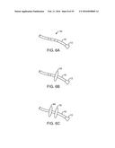 Tissue Visualization Device And Method Variations diagram and image