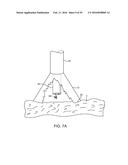 Tissue Visualization Device And Method Variations diagram and image