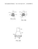 Tissue Visualization Device And Method Variations diagram and image