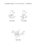 Tissue Visualization Device And Method Variations diagram and image