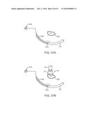 Tissue Visualization Device And Method Variations diagram and image