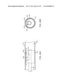 Tissue Visualization Device And Method Variations diagram and image