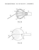 Tissue Visualization Device And Method Variations diagram and image