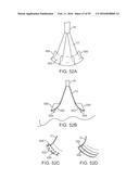 Tissue Visualization Device And Method Variations diagram and image