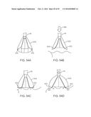 Tissue Visualization Device And Method Variations diagram and image