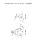 Tissue Visualization Device And Method Variations diagram and image