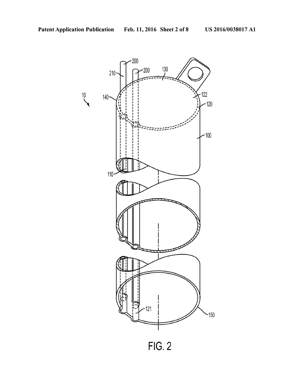 RETRACTOR VISION SYSTEM - diagram, schematic, and image 03