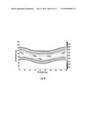 APPARATUS AND METHOD FOR MINIMIZING THE INFLUENCE OF CORNEAL BIREFRINGENCE     ON THE ANALYSIS OF EYE FIXATION AND FOCUS USING RETINAL BIREFRINGENCE     SCANNING diagram and image