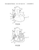 Cardiac tissue elasticity sensing diagram and image