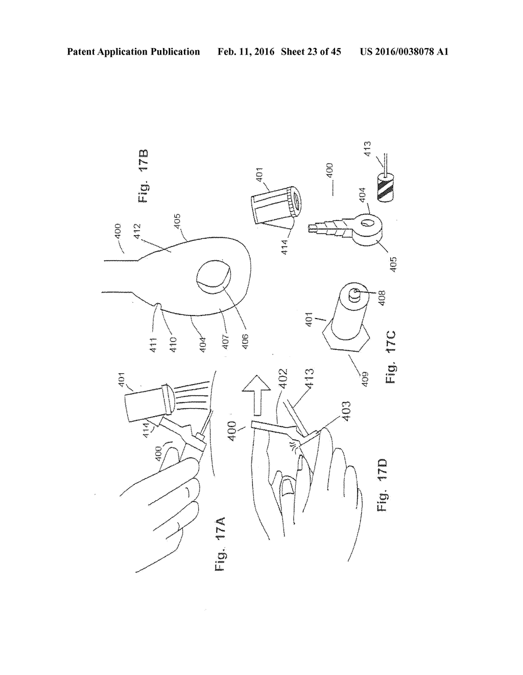 Vial/Syringe-Mounted Micro Vein Enhancer - diagram, schematic, and image 24