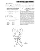 DEVICE FOR MEASUREMENT OF PRESSURE AND FOR ADMINISTRATION OF DRUGS TO AN     ANEURYSM IN A BLOOD VESSEL diagram and image