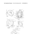 IMAGING SYSTEM AND METHOD diagram and image