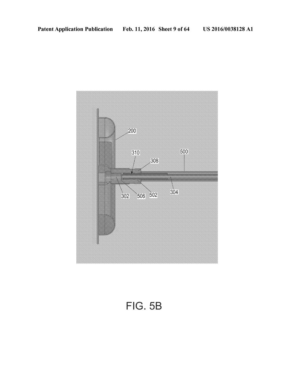 FISTULA TREATMENT DEVICES AND RELATED METHODS - diagram, schematic, and image 10